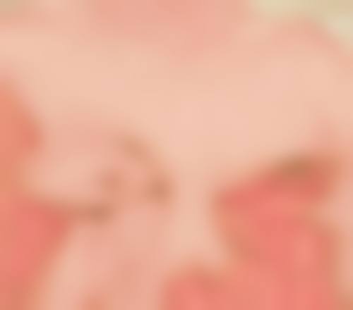 祛痣增生疤痕怎么才能去除之药物治疗早干预