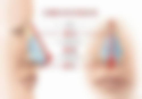 切除眼袋的疤痕多久才能好?警惕修复中的“红灯警报”