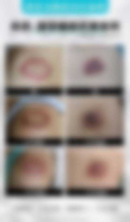 邯郸韩雅医疗美容诊所怎么样，更擅长什么手术