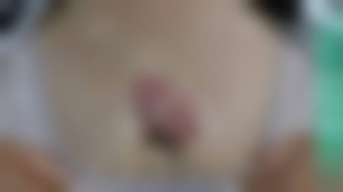 沈膺盛医生顾客实例展示