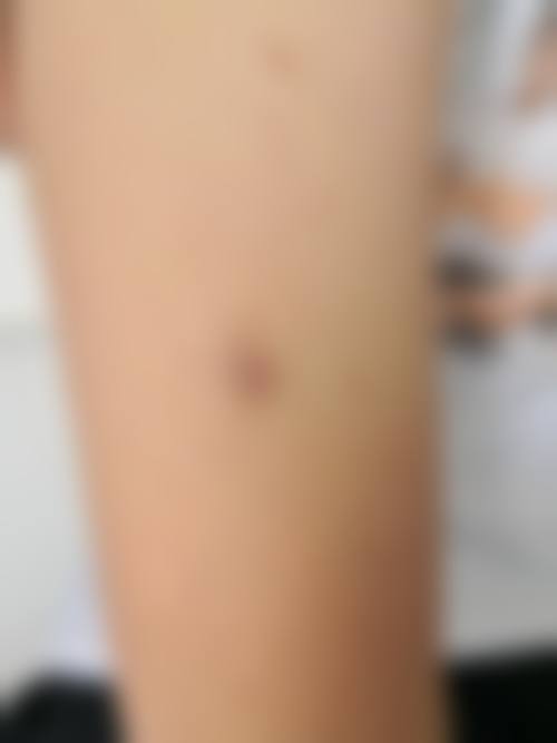 浙江杭州清沐医疗美容门诊部价格表