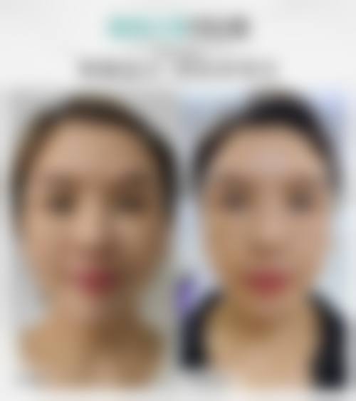 哈尔滨韩美整形口碑好不好