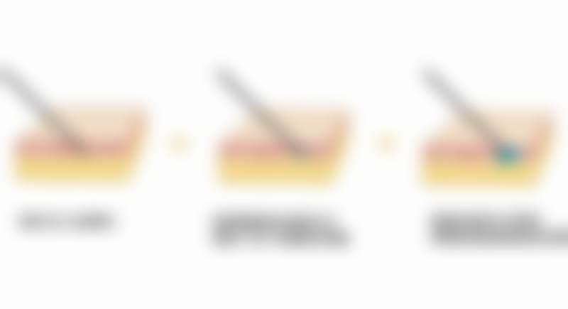 方锦平医生做手术价格