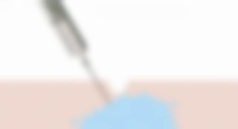 方锦平医生顾客实例图片