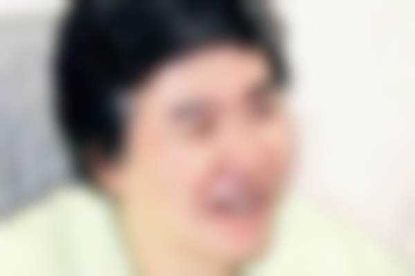 日本Bell美容外科诊所 涩谷怎么样，更擅长什么