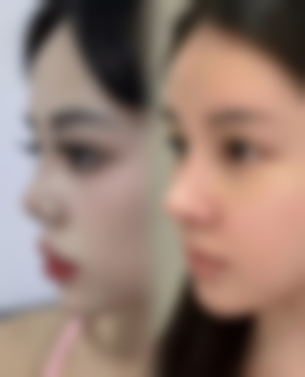 五、西安李永涛医疗美容整形医院医生简介