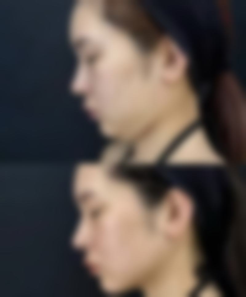 莆田辉荣医疗美容整形门诊部的顾客实例