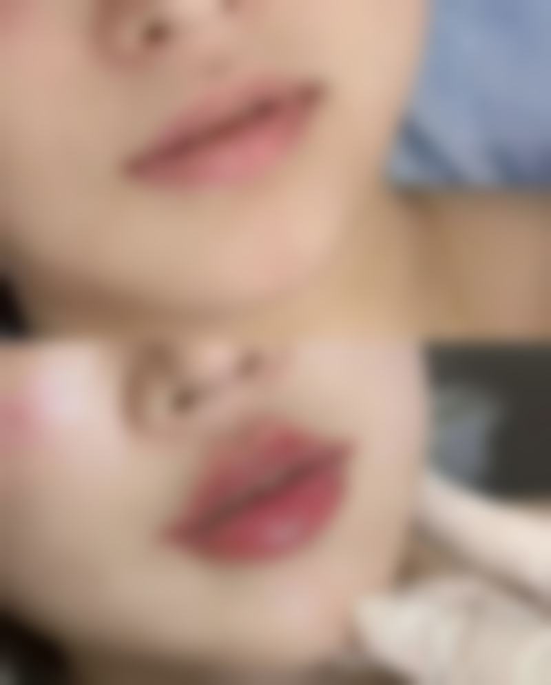 中医去除咬伤疤痕的深厚智慧传承