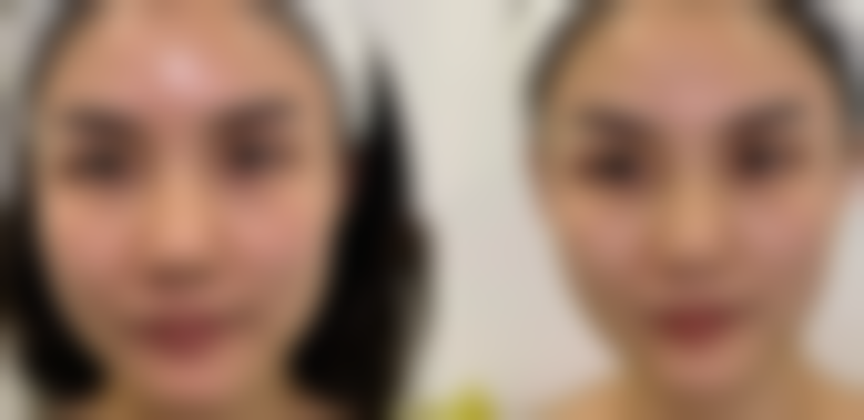 三、西安李永涛医疗美容整形医院怎么样,口碑评价如何?