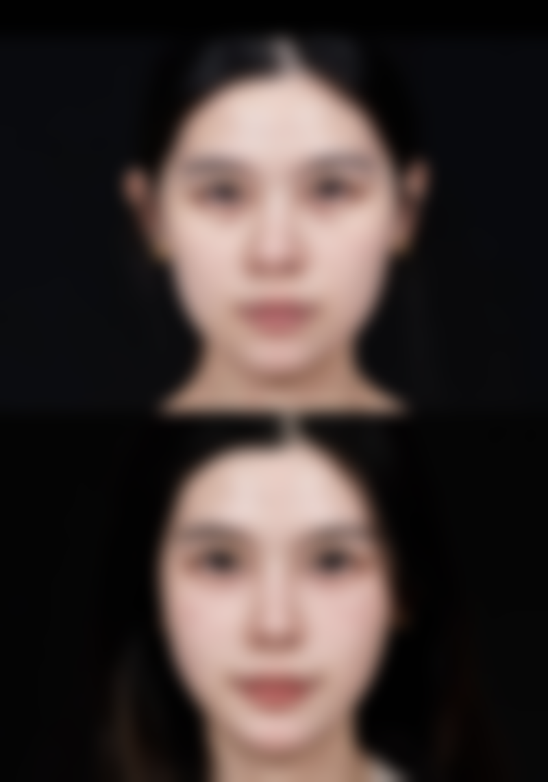 莆田辉荣医疗美容整形门诊部的价格表