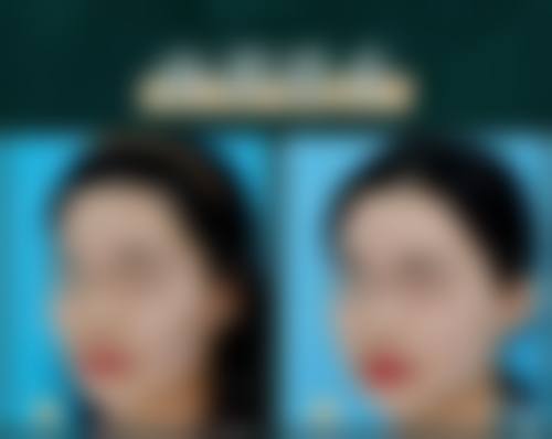 梁衍炜医生简介口碑如何