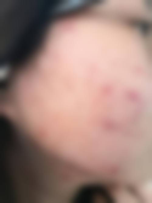 铁岭匠欣整形医院口碑好不好