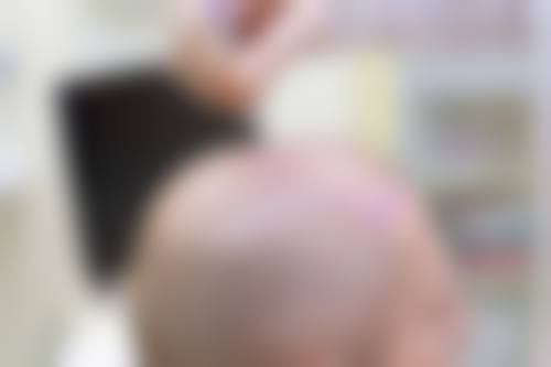 石家庄雍禾植发美容医院项目特色