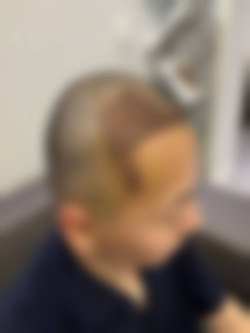 赵熙蕊医生简介做手术价格