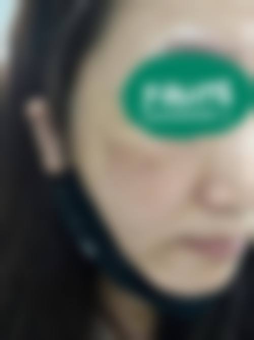 临沂医恒美整形医院价格表