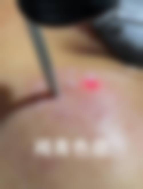 库尔勒梨城华南医院整形美容科口碑好不好?附真实患者口碑评价