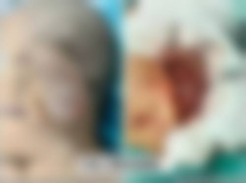 济南欧华整形医院怎么样口碑好不好?附真实患者口碑评价