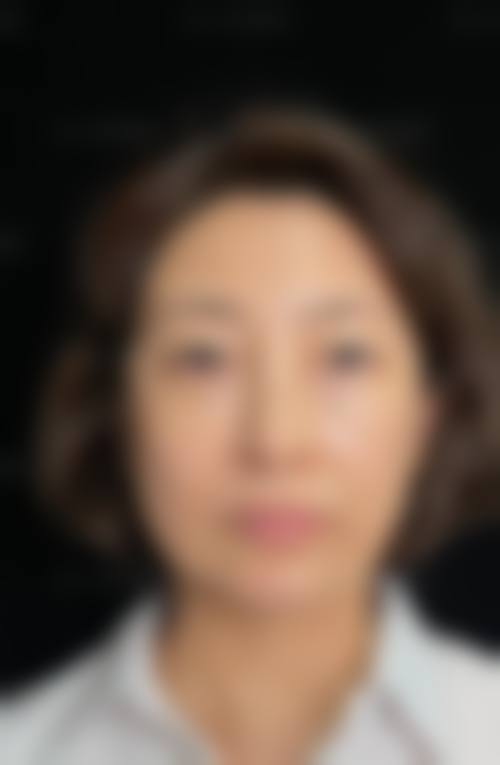 梁忠军 医生做手术价格情况