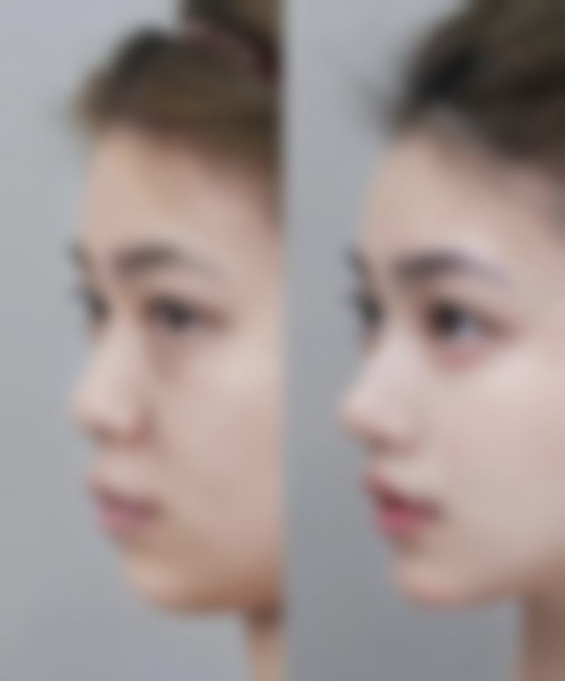 北京青柠医疗美容怎么样？抖音团购活动及价格表