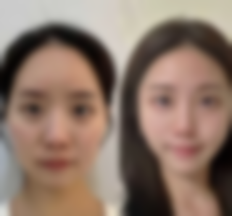 安庆嘉美美容整形诊所怎么样更擅长什么