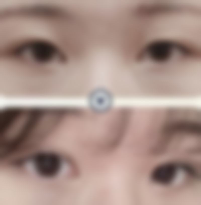 长春王广平整形诊所更擅长什么手术