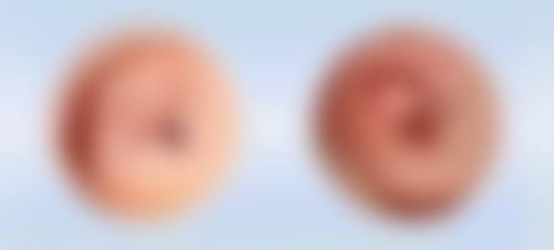 烟台壹美天成整形医疗美容医院口碑好不好？附真实患者口碑评价