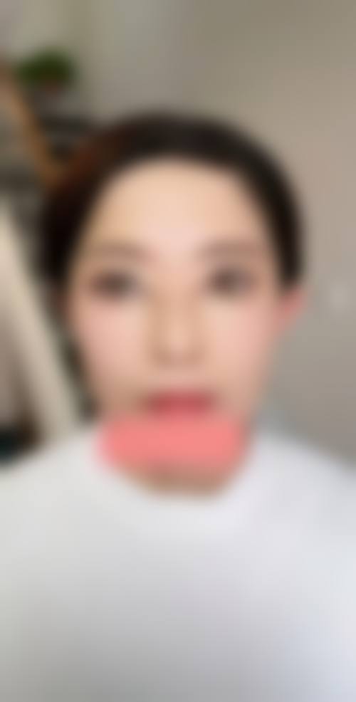 深圳华美医疗美容门诊部地址在哪里