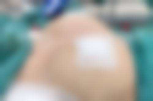 深圳华美医疗美容门诊部更擅长什么