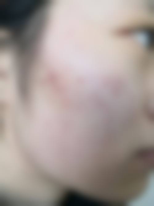 赵熙蕊医生简介项目优势