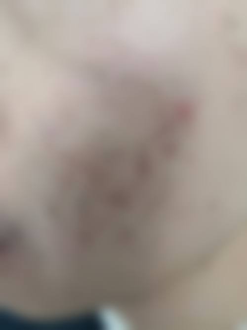 泉州赫尔本医疗美容门诊部怎么样