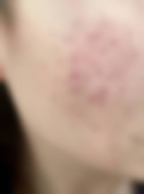 泉州赫尔本医疗美容门诊部价格表