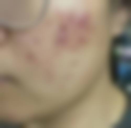 义乌淳愫医疗美容诊所评价