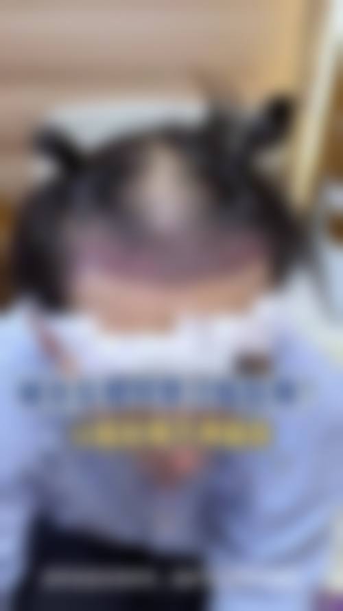 洛阳盛初未毛植发医院地址及乘车路线