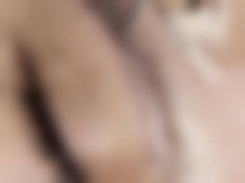 赵熙蕊医生简介做手术价格