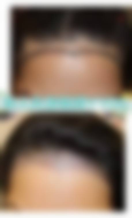 七、菏泽花容医疗美容门诊部的顾客实例分享