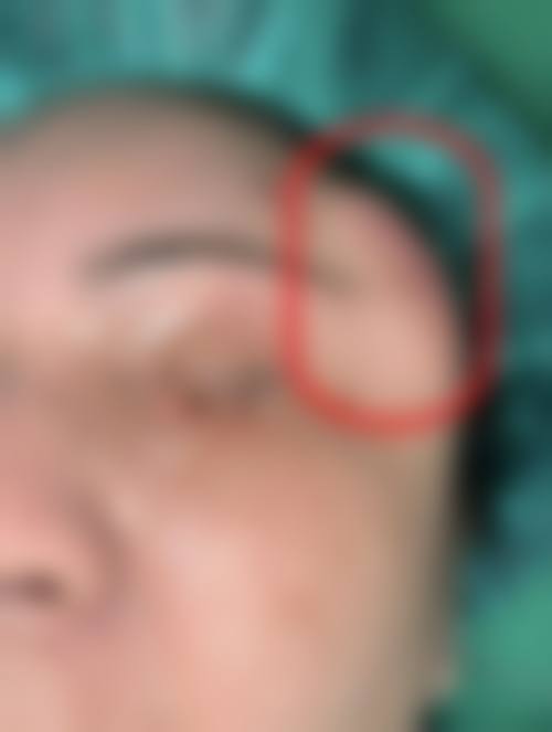 烟台壹美天成整形医疗美容医院价格表