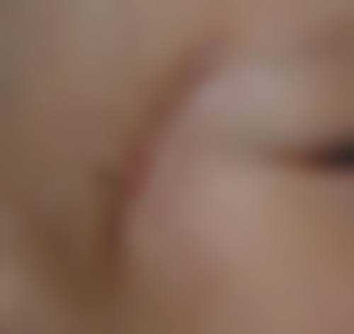 乌鲁木齐张瑞红整形口碑好不好