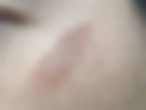 贵港晨妍整形医院项目特色