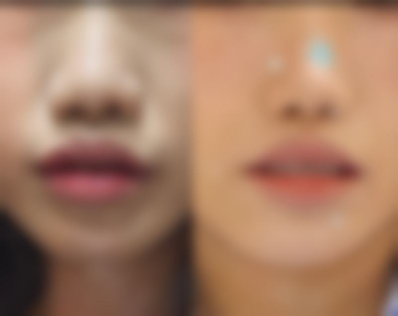 北京紫美韵整形医疗美容诊所怎么样,评价