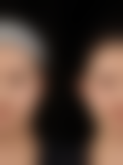 乌鲁木齐张瑞红整形正规吗