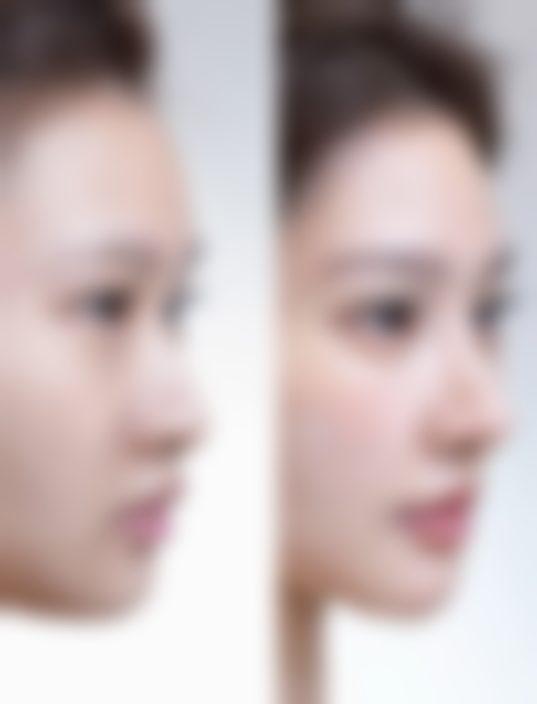 沈膺盛医生做手术价格