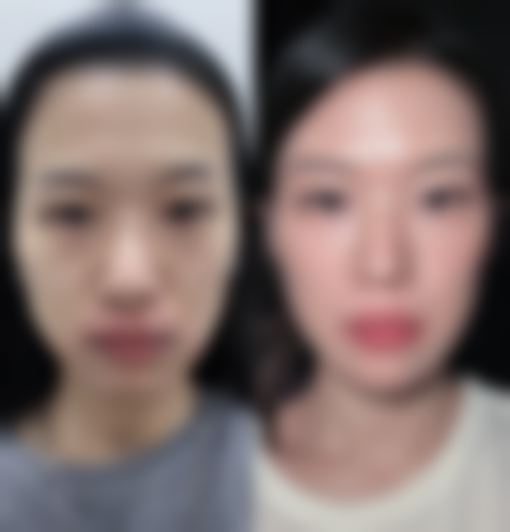 国内人民解放军第二一一医院整形美容中 心价格表