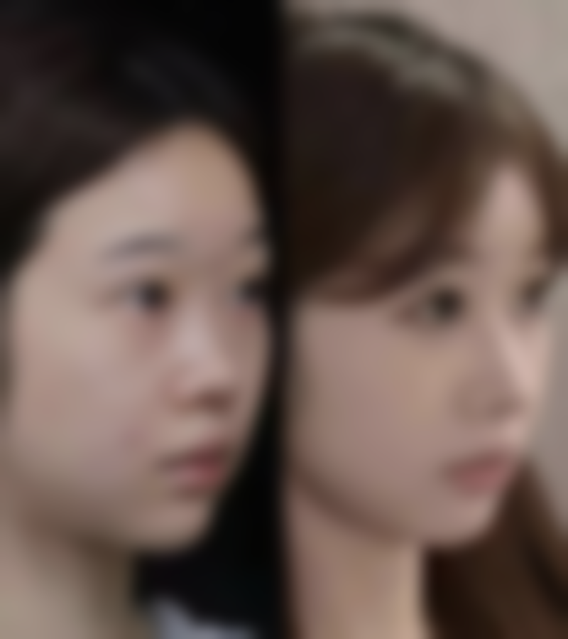 张远飞医生做手术价格与影响因素