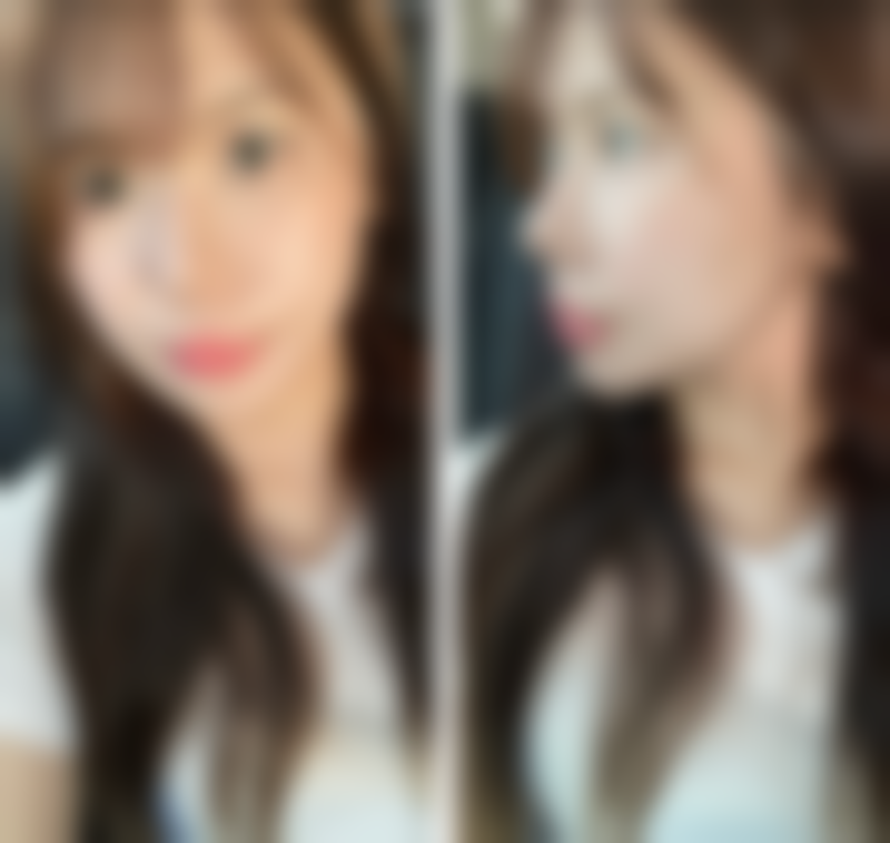 义乌淳愫医疗美容诊所可靠吗