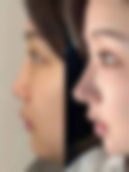 台州媚焕医疗美容门诊部价格表