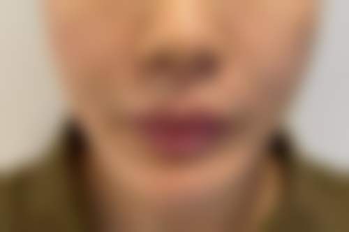 无锡芮博思医疗美容诊所怎么挂号,地址在哪儿