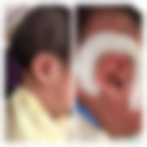 承德解放军第二六六医院整形美容医院口碑好不好？附真实患者口碑评价