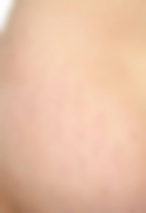 沭阳县孙宝厚整形医院价格表