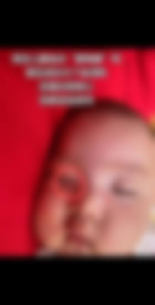 阜阳苗医生专精祛痘祛斑门诊部地址在哪里