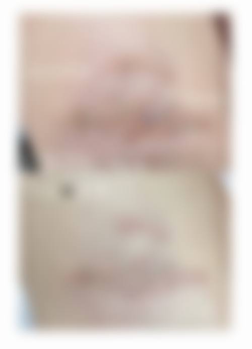 贵州凯婷凯钥医疗美容门诊部怎么样:特色项目优势